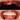 Dental implant procedure close up teeth