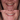 Quality dental implants turkey