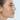 Ринопластика (rhinoplasty)