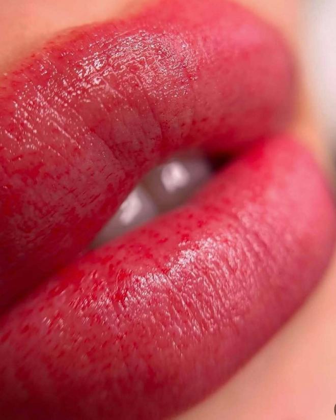 Labios