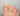 la micosi - Nailssecrets