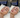 Hydrafacial Deluxe Wien
