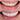 smile makeover zirconium crown 