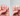macchia sospetta sull’unghia - Nailssecrets