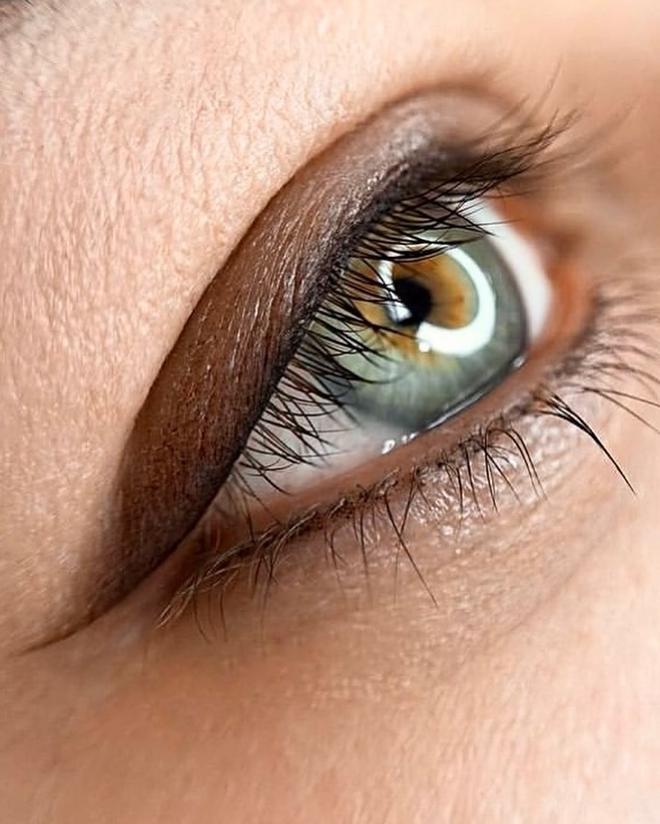 Ojos