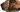 Face Up™ System