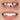 Emax veneers in Marmaris